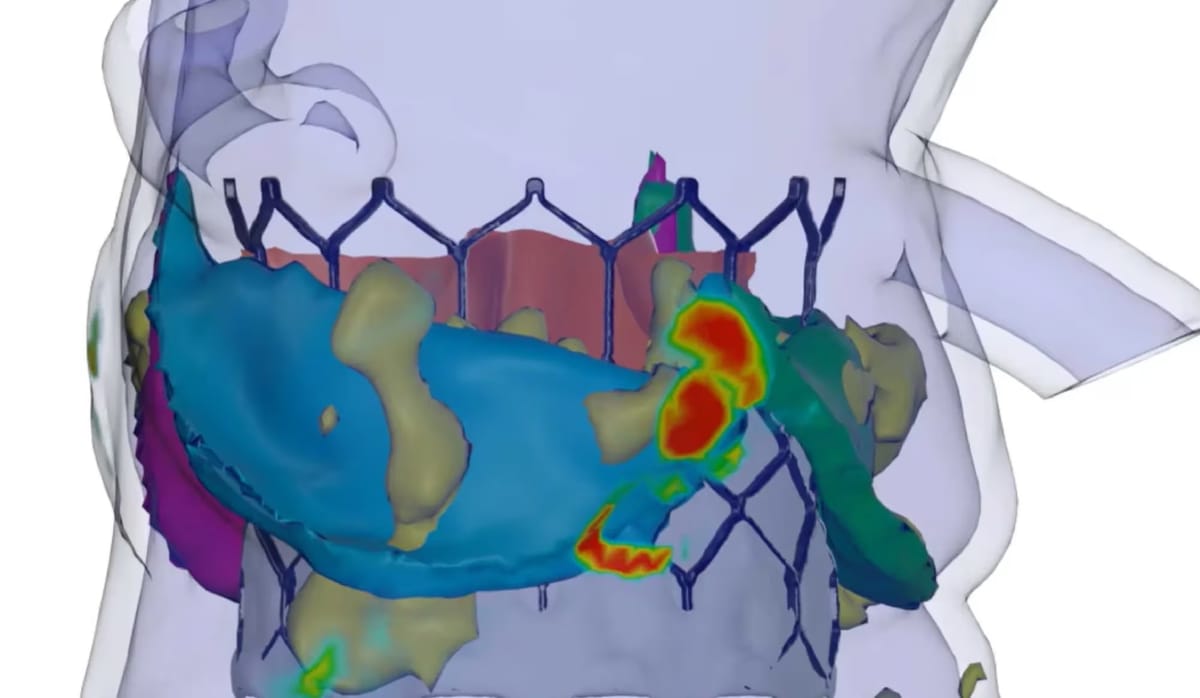 Cleveland Clinic and DASI Simulations partner on AI ‘Co-Pilot’ for heart procedures